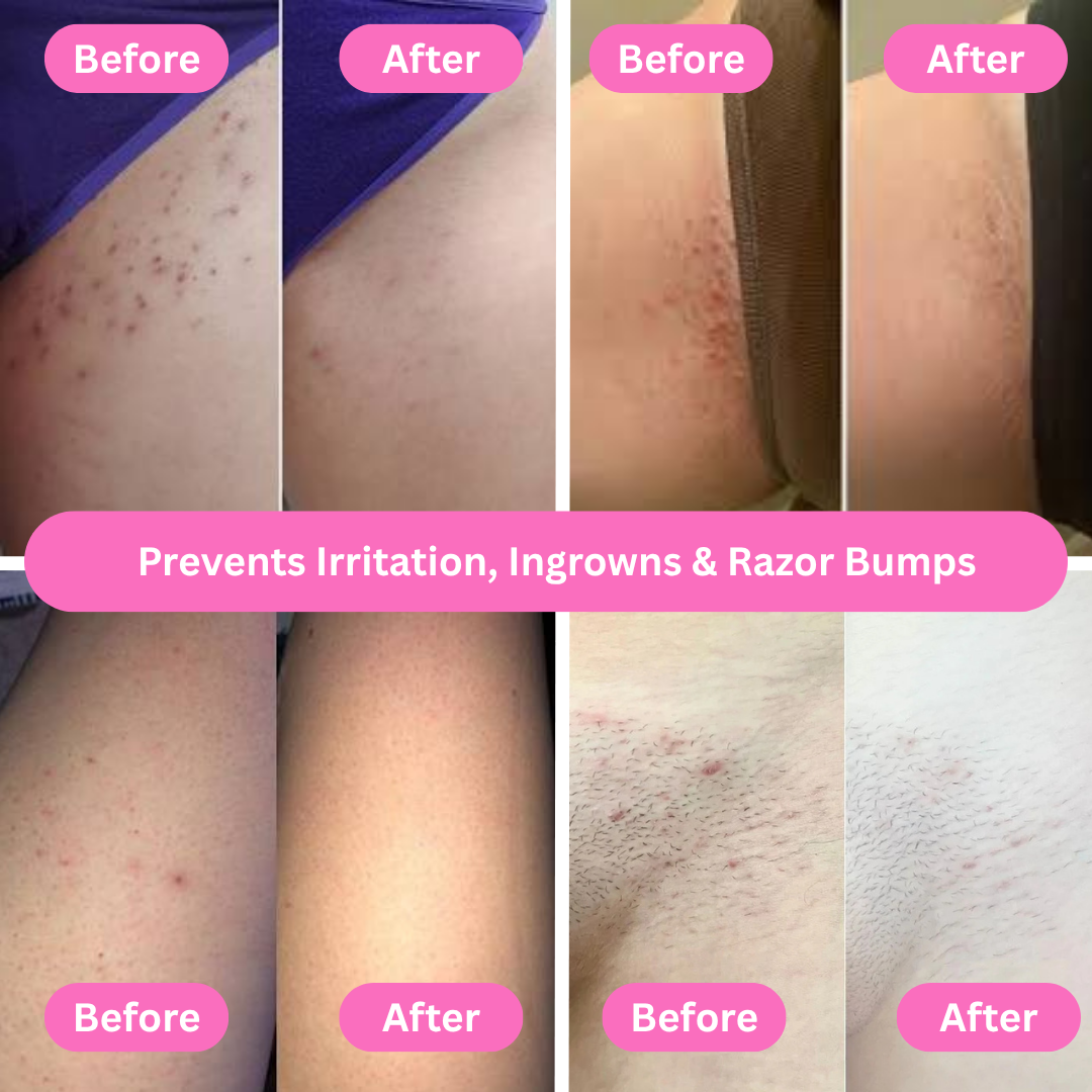 Dermavive Bare Glow Razor